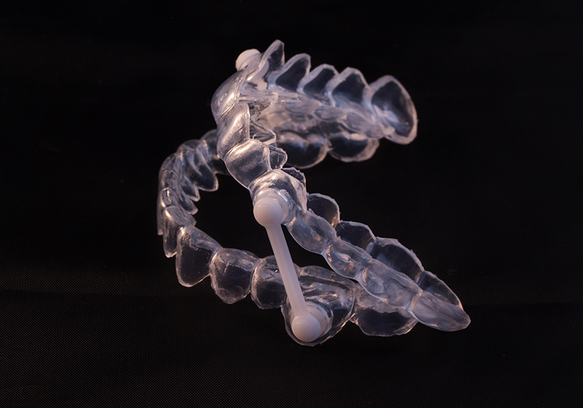 Close-up of oral appliance used to treat sleep apnea