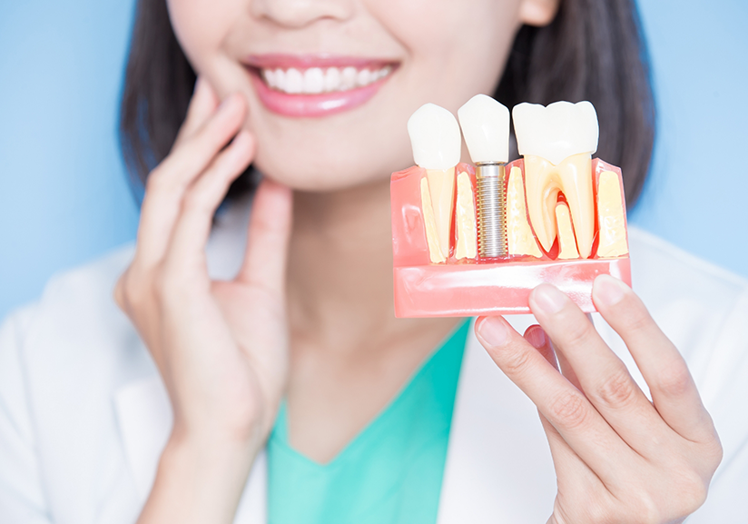 Close-up of female dentist holding model of dental implant