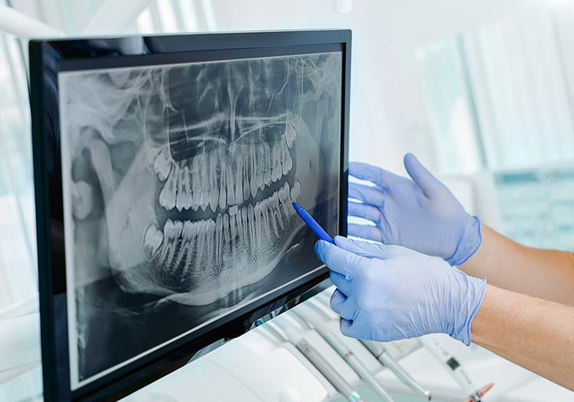 Looking at dental X-ray on monitor