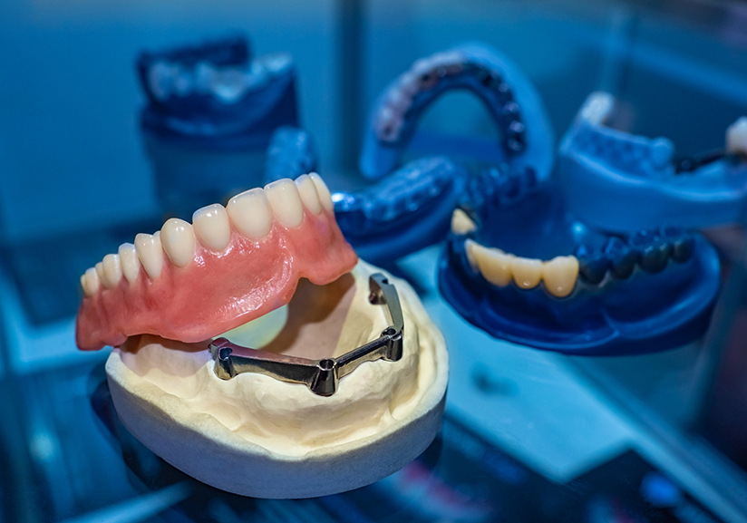 Dentures and dental implants in dental lab