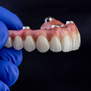 Gloved hand holding dentures for dental implants