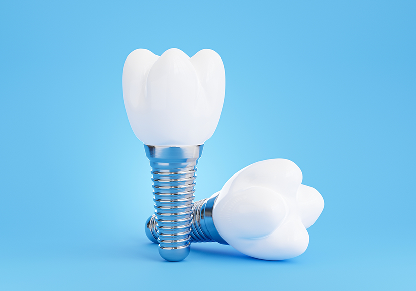 Two dental implants on a blue background