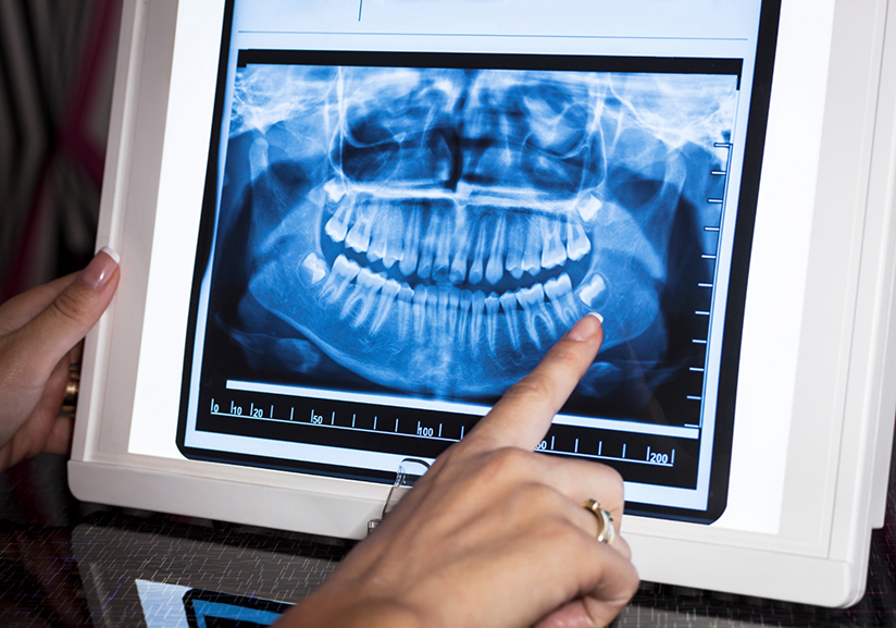 Pointing to X-ray of teeth on computer monitor