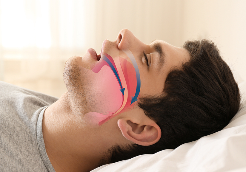 Sleeping man with diagram showing sleep apnea in Pantego