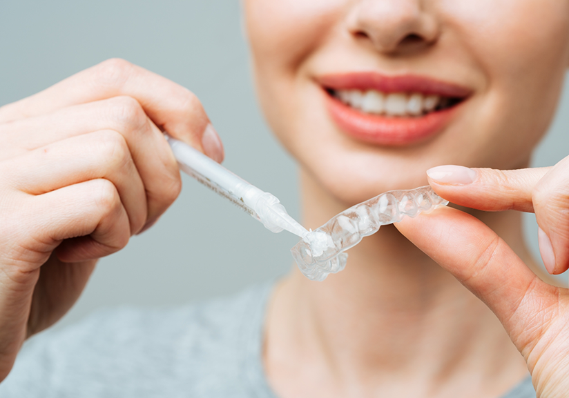 Woman holding whitening tray and filling it with gel